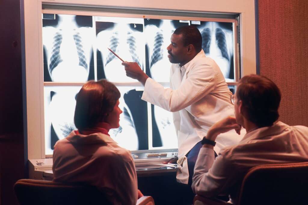 Radiologist examining chest X-rays displaying professional medical expertise