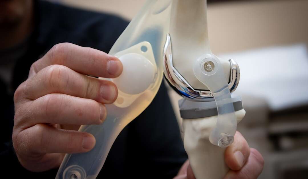 A physician's assistant holds up a model of a total joint knee replacement to show what was done during surgery in Pocatello, Idaho. Photo by Judy Beth Morris on Unsplash