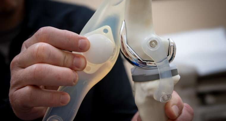 Knee Replacement in Kennesaw, Georgia: Complete Guide to Surgery & Recovery