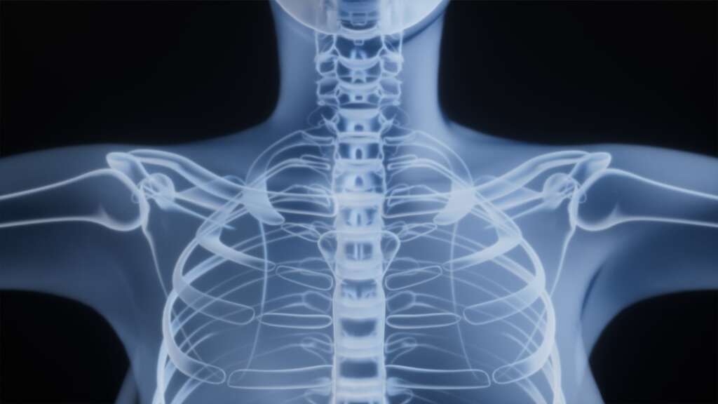 X-ray image showing human spine and torso anatomy for lower back pain diagnosis
