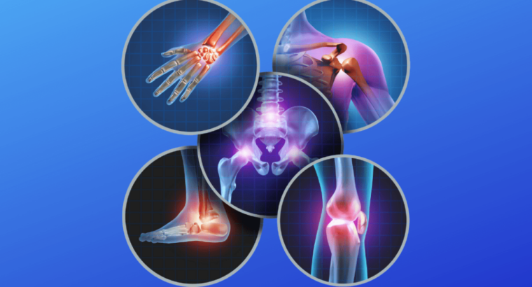 Don’t Be Fooled: 5 Orthopaedic Myths That Are Hurting Your Progress