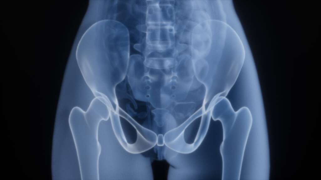 X-ray image of human pelvis and hip joints showing bone structure