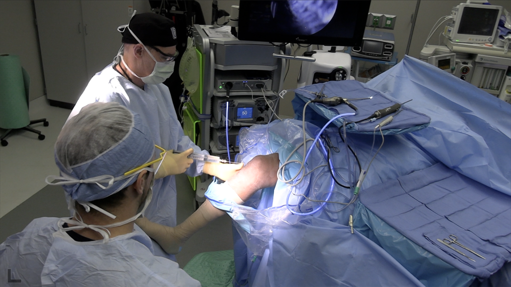 Surgeons in masks and gowns perform a leg surgery under blue drapes in an operating room with monitoring equipment nearby.