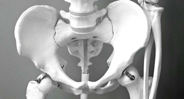 Hip Replacement in Cumming, Georgia: Complete Guide to Surgery & Recovery