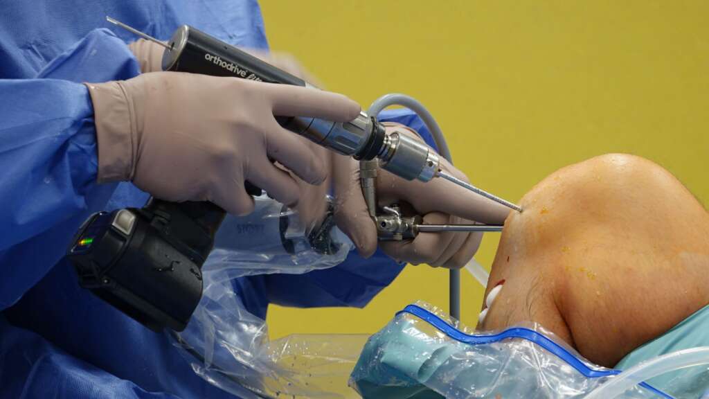 Orthopedic surgeon performing knee arthroscopy as an advanced treatment option at Jacksonville orthopedic practice