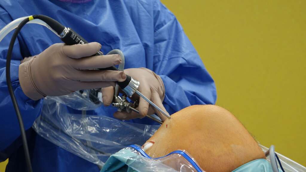 Orthopedic surgeon performing knee surgery using arthroscopic instruments in an operating room