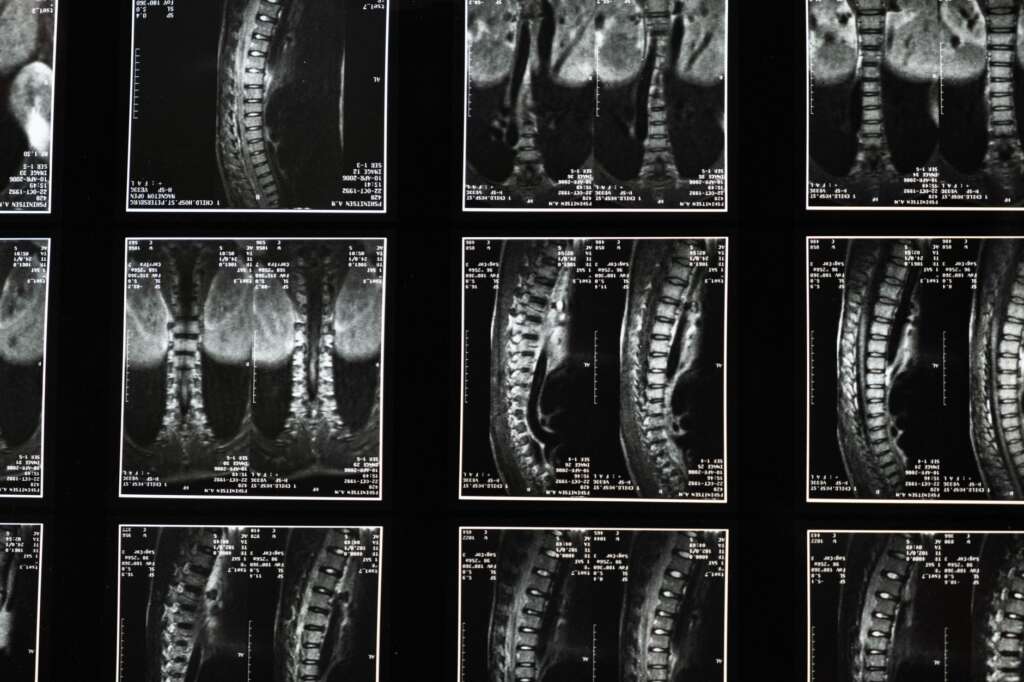 Comprehensive spinal MRI scan images used in orthopedic diagnosis and treatment planning