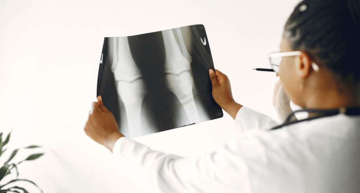 Orthopedic doctor reviewing knee X-ray for patient evaluation at Barbour Orthopaedics & Spine Jacksonville FL