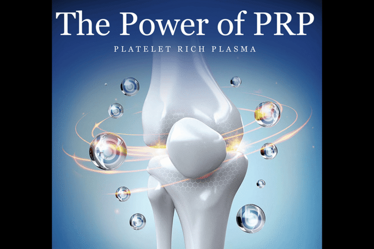 PRP Injections for Athletes: Benefits, Recovery & Return to Sport